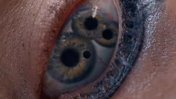 Extreme closeup of an eye with multiple pupils and damaged surrounding tissue