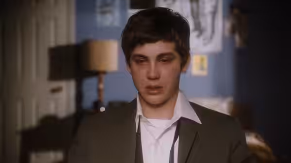 Charlie (Logan Lerman) with a bruised face looks down in a bedroom
