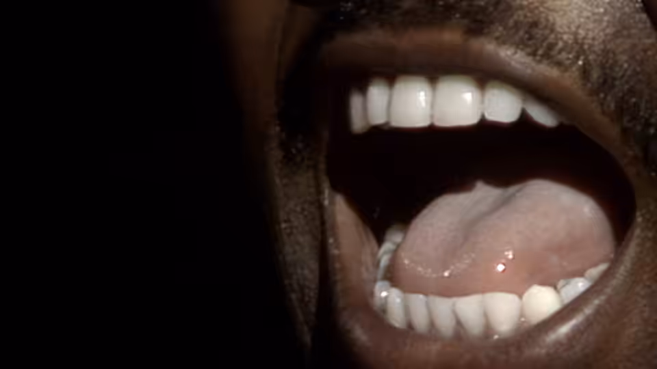 A close-up of a person's open mouth, with teeth and tongue visible against a dark background