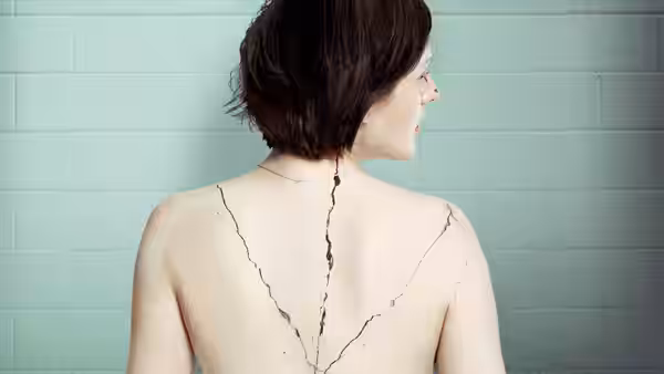 woman with short hair viewed from back showing dark line on skin