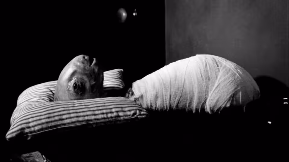 an infant with oversized head wrapped in cloth on striped pillow