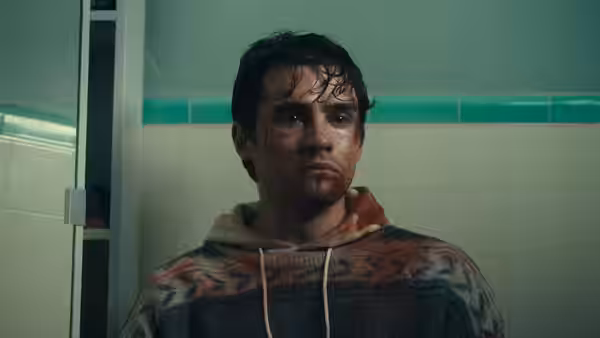 A young man with a bruised face stands in a bathroom