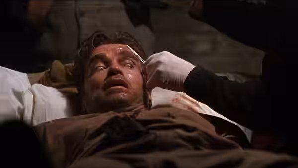 A wounded, bearded man lies on a table as someone tends his face