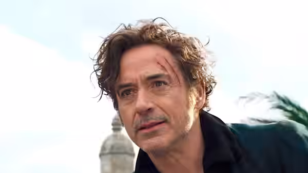 Dr. John Dolittle (Robert Downey Jr.) with a forehead cut looking upwards