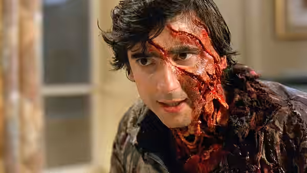 David Kessler (David Naughton) with bloodied face and torn skin